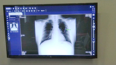 В Кузбассе приступили к созданию системы передачи и хранения цифровых медицинских изображений