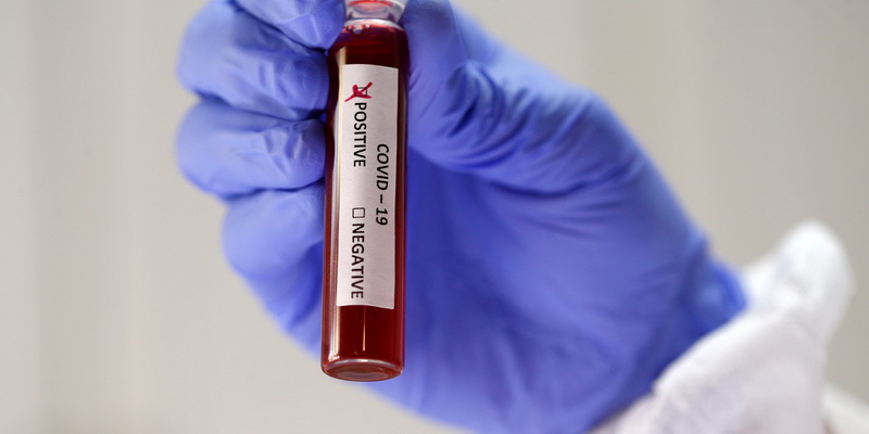 В Кузбассе четвертая лаборатория начала делать тесты на коронавирус