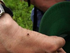 Клещевой энцефалит подтверждён у восьми жителей Кузбасса