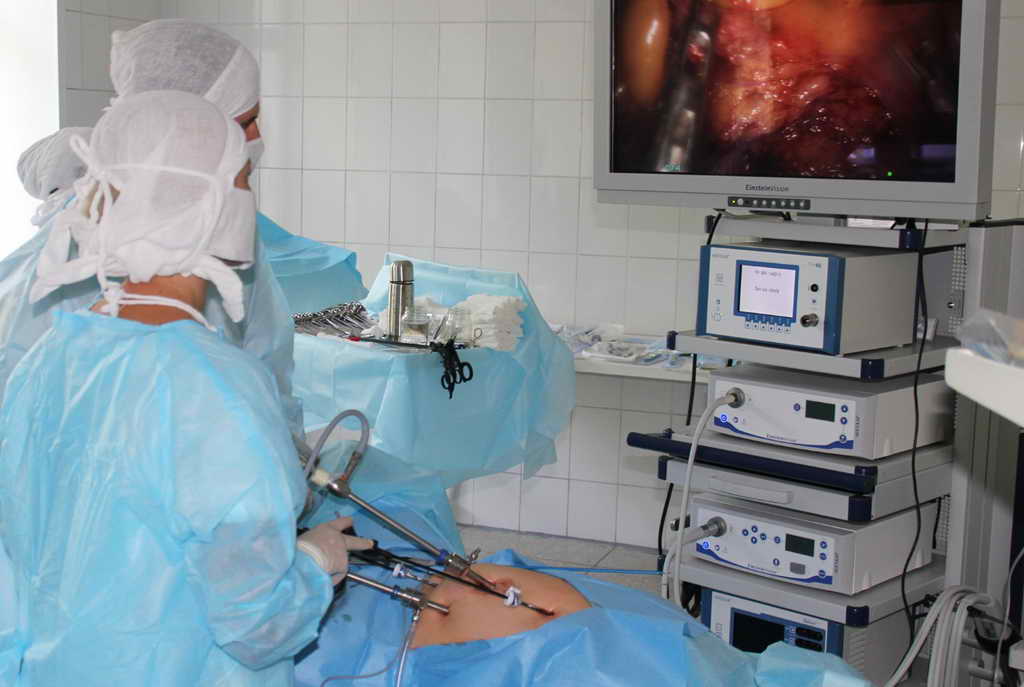 В Новокузнецкой городской больнице №29 проведена редкая операция пациенту с тотальным полипозом толстой кишки