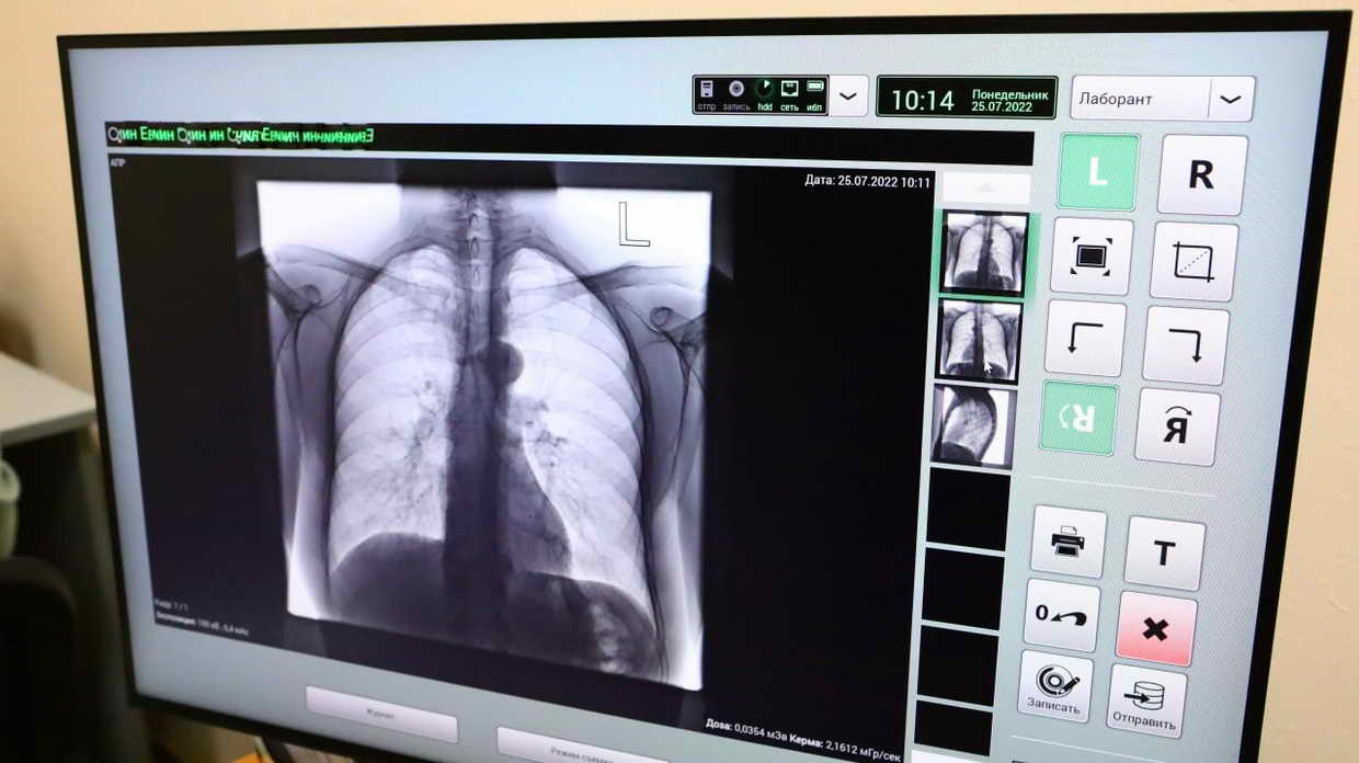 В новокузнецком филиале Кузбасского кардиологического диспансера начал работать новый флюорограф