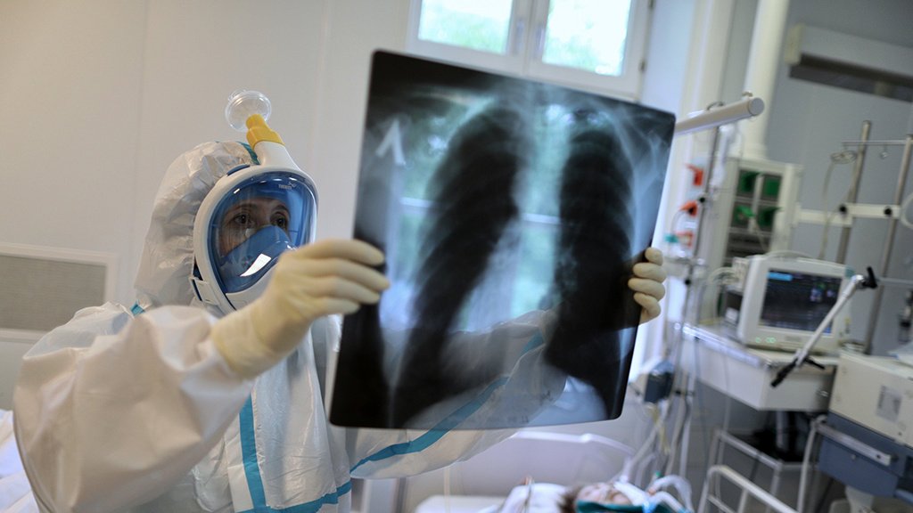 Врач объяснил, можно ли восстановить легкие после тяжелого COVID-19