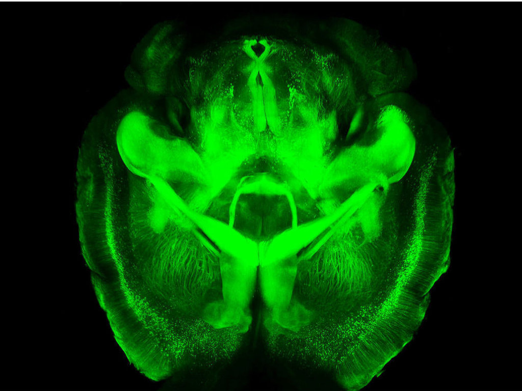 Ученые измерили синаптическую передачу в мозге животного